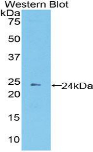 PCDHB2 / Protocadherin Beta 2 Antibody - Western blot of recombinant PCDHB2 / Protocadherin Beta 2.  This image was taken for the unconjugated form of this product. Other forms have not been tested.
