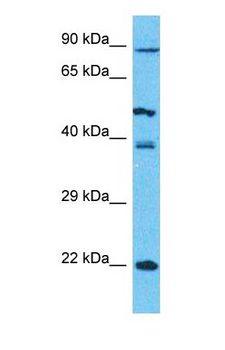 PCDHB5 Antibody - Western blot of PCDHB5 Antibody with human 293T Whole Cell lysate.  This image was taken for the unconjugated form of this product. Other forms have not been tested.
