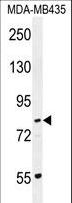 PCDHGA1 Antibody - PCDHGA1 Antibody western blot of MDA-MB435 cell line lysates (35 ug/lane). The PCDHGA1 antibody detected the PCDHGA1 protein (arrow).