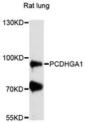 PCDHGA1 Antibody - Western blot analysis of extracts of rat lung, using PCDHGA1 antibody at 1:3000 dilution. The secondary antibody used was an HRP Goat Anti-Rabbit IgG (H+L) at 1:10000 dilution. Lysates were loaded 25ug per lane and 3% nonfat dry milk in TBST was used for blocking. An ECL Kit was used for detection and the exposure time was 90s.