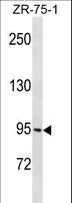 PCDHGB1 Antibody - PCDHGB1 Antibody western blot of ZR-75-1 cell line lysates (35 ug/lane). The PCDHGB1 antibody detected the PCDHGB1 protein (arrow).