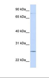 PCDHGC3 / PCDH2 Antibody - 721_B cell lysate. Antibody concentration: 1.0 ug/ml. Gel concentration: 12%.  This image was taken for the unconjugated form of this product. Other forms have not been tested.