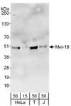 PCGF2 / MEL-18 Antibody - Detection of Human Mel-18 by Western Blot. Samples: Whole cell lysate from HeLa (15 and 50 ug), 293T (T; 50 ug) and Jurkat (J; 50 ug) cells. Antibodies: Affinity purified rabbit anti-Mel-18 antibody used for WB at 0.1 ug/ml. Detection: Chemiluminescence with an exposure time of 3 minutes.
