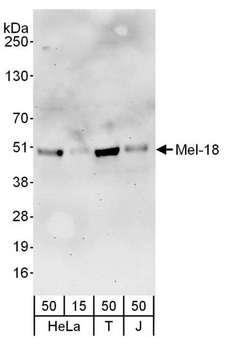 PCGF2 / MEL-18 Antibody - Detection of Human Mel-18 by Western Blot. Samples: Whole cell lysate from HeLa (15 and 50 ug), 293T (T; 50 ug) and Jurkat (J; 50 ug) cells. Antibodies: Affinity purified rabbit anti-Mel-18 antibody used for WB at 0.1 ug/ml. Detection: Chemiluminescence with an exposure time of 3 minutes.
