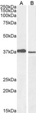 PCGF2 / MEL-18 Antibody - Staining (1?g/ml) of A549 (A) and PD19 (B) cell lysate (RIPA buffer, 30?g total protein per lane). Detected by chemiluminescence.
