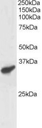 PCGF3 Antibody - Antibody staining (1 ug/ml) of Human Heart lysate (RIPA buffer, 30 ug total protein per lane). Primary incubated for 1 hour. Detected by Western blot of chemiluminescence.