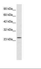 PCGF3 Antibody - Jurkat Cell Lysate.  This image was taken for the unconjugated form of this product. Other forms have not been tested.