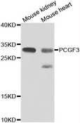 PCGF3 Antibody - Western blot analysis of extracts of various cell lines.