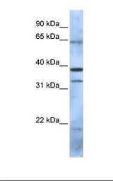 PCGF5 Antibody - 293T cell lysate. Antibody concentration: 1.0 ug/ml. Gel concentration: 12%.  This image was taken for the unconjugated form of this product. Other forms have not been tested.