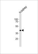 PCGF6 Antibody - Western blot of lysate from human kidney tissue with PCGF6 Antibody. Antibody was diluted at 1:1000. A goat anti-rabbit IgG H&L (HRP) at 1:10000 dilution was used as the secondary antibody. Lysate at 20 ug.