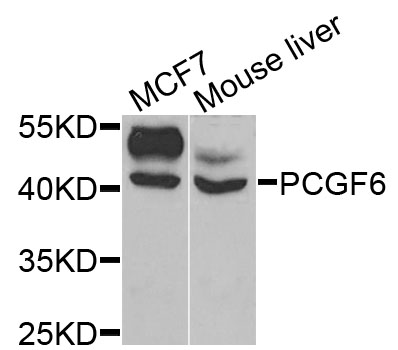 PCGF6 Antibody - Western blot analysis of extracts of various cells.