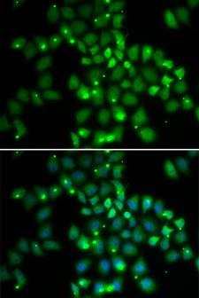 PCGF6 Antibody - Immunofluorescence analysis of HeLa cells.