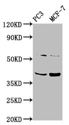 PCGF6 Antibody - Western Blot Positive WB detected in: PC3 whole cell lysate, MCF-7 whole cell lysate All Lanes: PCGF6 antibody at 3.1µg/ml Secondary Goat polyclonal to rabbit IgG at 1/50000 dilution Predicted band size: 40, 31 KDa Observed band size: 40 KDa