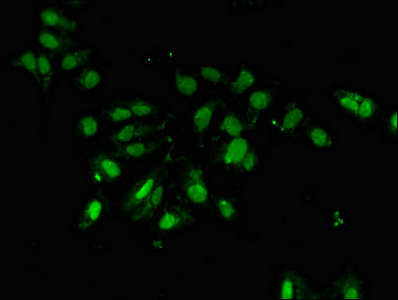 PCID2 Antibody - Immunofluorescent analysis of Hela cells diluted at 1:100 and Alexa Fluor 488-congugated AffiniPure Goat Anti-Rabbit IgG(H+L)