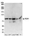 PCIF1 Antibody - Detection of human and mouse PCIF1 by western blot. Samples: Whole cell lysate (50 µg) from HeLa, HEK293T, Jurkat, mouse TCMK-1, and mouse NIH 3T3 cells prepared using NETN lysis buffer. Antibodies: Affinity purified rabbit anti-PCIF1 antibody used for WB at 0.4 µg/ml. Detection: Chemiluminescence with an exposure time of 3 minutes.