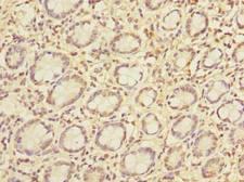 PCIF1 Antibody - Immunohistochemistry of paraffin-embedded human small intestine tissue using antibody at dilution of 1:100.