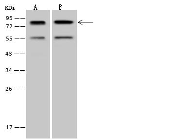 PCIF1 Antibody - Anti-PCIF1 rabbit polyclonal antibody at 1:500 dilution. Lane A: Hela Whole Cell Lysate. Lane B: Jurkat Whole Cell Lysate. Lysates/proteins at 30 ug per lane. Secondary: Goat Anti-Rabbit IgG (H+L)/HRP at 1/10000 dilution. Developed using the ECL technique. Performed under reducing conditions. Predicted band size: 81 kDa. Observed band size: 81 kDa.