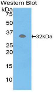 PCK1 Antibody - Western blot of recombinant PCK1.  This image was taken for the unconjugated form of this product. Other forms have not been tested.