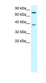 PCK1 Antibody - PCK1 antibody Western blot of Jurkat lysate. This image was taken for the unconjugated form of this product. Other forms have not been tested.