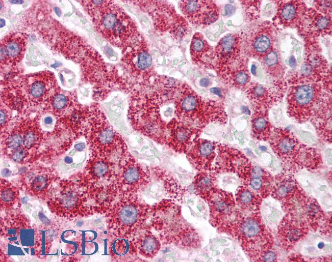 PCK1 Antibody - Anti-PCK1 antibody IHC of human liver. Immunohistochemistry of formalin-fixed, paraffin-embedded tissue after heat-induced antigen retrieval. Antibody concentration 5 ug/ml.  This image was taken for the unconjugated form of this product. Other forms have not been tested.