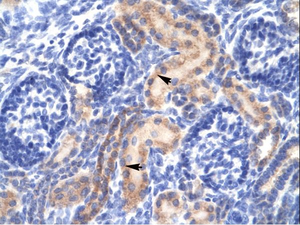 PCK1 Antibody - PCK1 antibody ARP32801_T100-NP_002582-PCK1 (phosphoenolpyruvate carboxykinase 1 (soluble)) Antibody was used in IHC to stain formalin-fixed, paraffin-embedded human kidney.  This image was taken for the unconjugated form of this product. Other forms have not been tested.