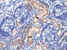 PCK1 Antibody - PCK1 antibody ARP32801_T100-NP_002582-PCK1 (phosphoenolpyruvate carboxykinase 1 (soluble)) Antibody was used in IHC to stain formalin-fixed, paraffin-embedded human kidney.  This image was taken for the unconjugated form of this product. Other forms have not been tested.