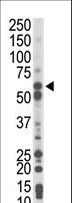 PCK1 Antibody - The anti-PCK1 antibody is used in Western blot to detect PCK1 in mouse liver tissue lysate.