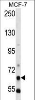 PCK1 Antibody - PCK1 Antibody western blot of MCF-7 cell line lysates (35 ug/lane). The PCK1 antibody detected the PCK1 protein (arrow).