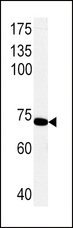 PCK1 Antibody - Western blot of PCK1 Antibody in rat primary hepatocyte cell line lysates. PCK1 (arrow) was detected using the purified antibody.