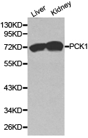 PCK1 Antibody - Western blot of extracts of various cell lines, using PCK1 antibody.