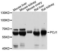 PCK1 Antibody - Western blot analysis of extracts of various cell lines.