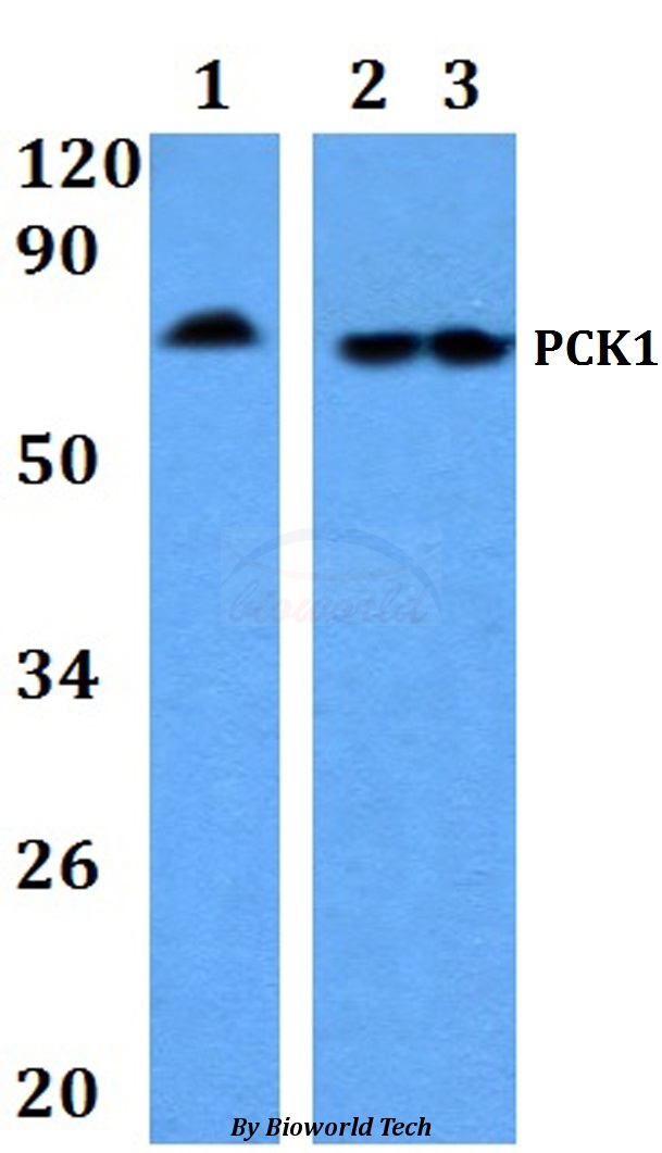 PCK1 Antibody - Western blot of PCK1 antibody at 1:500 dilution. Lane 1: HeLa whole cell lysate. Lane 2: Raw264.7 whole cell lysate. Lane 3: The intestine tissue lysate of Rat.