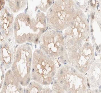 PCK1 Antibody - 1:100 staining human kidney tissue by IHC-P. The tissue was formaldehyde fixed and a heat mediated antigen retrieval step in citrate buffer was performed. The tissue was then blocked and incubated with the antibody for 1.5 hours at 22°C. An HRP conjugated goat anti-rabbit antibody was used as the secondary.