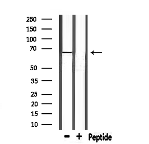 PCK1 Antibody - Western blot analysis of extracts of rat spleen using PCK1 antibody.