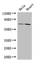 PCK2 / PEPCK Antibody - Western Blot Positive WB detected in: Hela whole cell lysate, Mouse heart tissue All lanes: PCK2 antibody at 3.4µg/ml Secondary Goat polyclonal to rabbit IgG at 1/50000 dilution Predicted band size: 71, 48 kDa Observed band size: 71 kDa