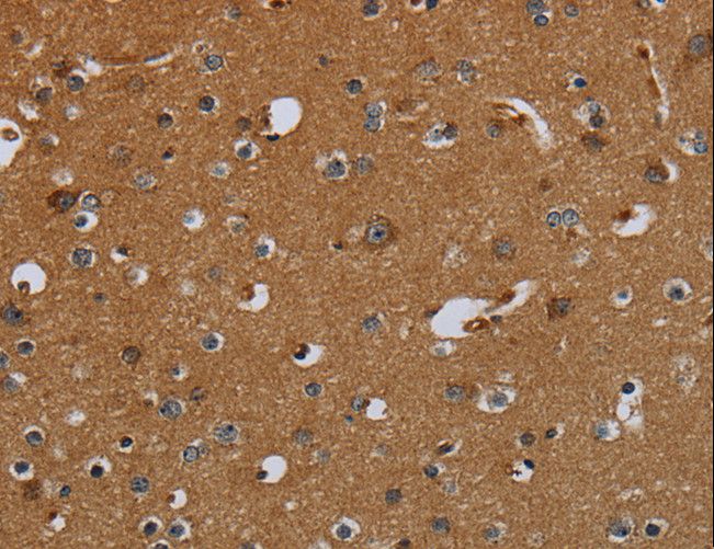 PCK2 / PEPCK Antibody - Immunohistochemistry of paraffin-embedded Human brain using PCK2 Polyclonal Antibody at dilution of 1:60.