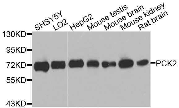 PCK2 / PEPCK Antibody - Western blot analysis of extracts of various cells.