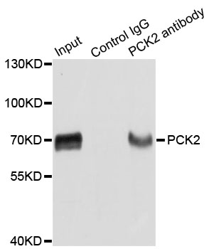 PCK2 / PEPCK Antibody - Immunoprecipitation analysis of extracts of HepG2 cells.