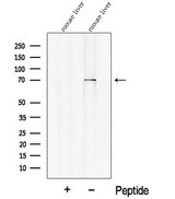 PCK2 / PEPCK Antibody - Western blot analysis of extracts of HeLa cells using PCK2 antibody. The lane on the left was treated with blocking peptide.