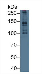 PCM1 Antibody - Western Blot; Sample: Human Hela cell lysate; Primary Ab: 1µg/ml Rabbit Anti-Human PCM1 Antibody Second Ab: 0.2µg/mL HRP-Linked Caprine Anti-Rabbit IgG Polyclonal Antibody