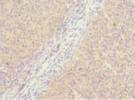 PCM1 Antibody - Immunohistochemistry of paraffin-embedded human tonsil tissue at dilution 1:100