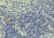 PCM1 Antibody - 1:100 staining human lymph tissue by IHC-P. The sample was formaldehyde fixed and a heat mediated antigen retrieval step in citrate buffer was performed. The sample was then blocked and incubated with the antibody for 1.5 hours at 22°C. An HRP conjugated goat anti-rabbit antibody was used as the secondary.