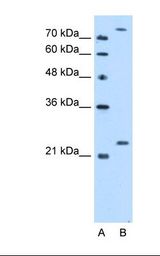 PCMT1 Antibody - Lane A: Marker. Lane B: HepG2 cell lysate. Antibody concentration: 2.5 ug/ml. Gel concentration: 12%.  This image was taken for the unconjugated form of this product. Other forms have not been tested.