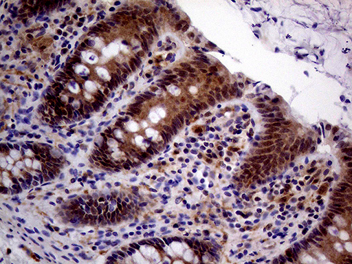 PCMT1 Antibody - Immunohistochemical staining of paraffin-embedded Human colon tissue within the normal limits using anti-PCMT1 mouse monoclonal antibody. (Heat-induced epitope retrieval by 1mM EDTA in 10mM Tris buffer. (pH8.5) at 120°C for 3 min. (1:2000)