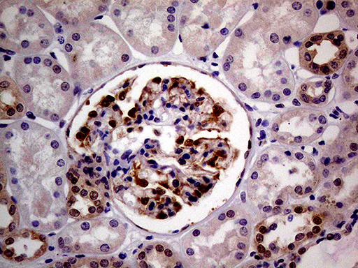PCMT1 Antibody - Immunohistochemical staining of paraffin-embedded Human Kidney tissue within the normal limits using anti-PCMT1 mouse monoclonal antibody. (Heat-induced epitope retrieval by 1mM EDTA in 10mM Tris buffer. (pH8.5) at 120°C for 3 min. (1:2000)