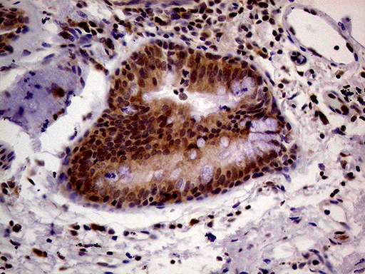 PCMT1 Antibody - Immunohistochemical staining of paraffin-embedded Human lung tissue within the normal limits using anti-PCMT1 mouse monoclonal antibody. (Heat-induced epitope retrieval by 1mM EDTA in 10mM Tris buffer. (pH8.5) at 120°C for 3 min. (1:2000)
