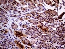 PCMT1 Antibody - Immunohistochemical staining of paraffin-embedded Human pancreas tissue within the normal limits using anti-PCMT1 mouse monoclonal antibody. (Heat-induced epitope retrieval by 1mM EDTA in 10mM Tris buffer. (pH8.5) at 120°C for 3 min. (1:2000)