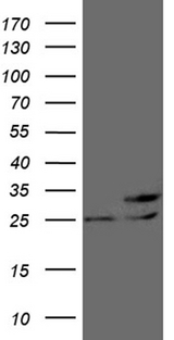 PCMT1 Antibody - HEK293T cells were transfected with the pCMV6-ENTRY control. (Left lane) or pCMV6-ENTRY PCMT1. (Right lane) cDNA for 48 hrs and lysed. Equivalent amounts of cell lysates. (5 ug per lane) were separated by SDS-PAGE and immunoblotted with anti-PCMT1. (1:2000)
