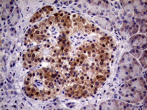 PCMT1 Antibody - Immunohistochemical staining of paraffin-embedded Human pancreas tissue within the normal limits using anti-PCMT1 mouse monoclonal antibody. (Heat-induced epitope retrieval by 1mM EDTA in 10mM Tris buffer. (pH8.5) at 120°C for 3 min. (1:500)