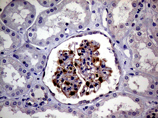 PCMT1 Antibody - Immunohistochemical staining of paraffin-embedded Human Kidney tissue within the normal limits using anti-PCMT1 mouse monoclonal antibody. (Heat-induced epitope retrieval by 1mM EDTA in 10mM Tris buffer. (pH8.5) at 120°C for 3 min. (1:500)